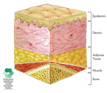 illustration of a cross-section of normal, healthy skin