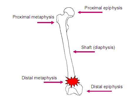 Diagram of long bone showing the locations of the metaphysis, epiphysis and diaphysis.