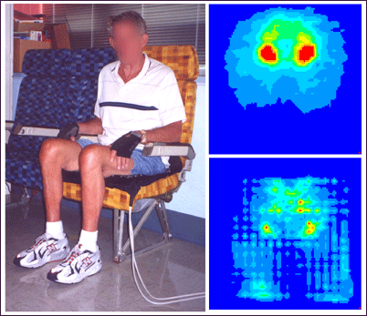 Figure 10: Pressure map while sitting in an airplane seat without a cushion (top) shows high pressure areas (red). Adding a cushion (bottom) reduces pressure on skin.