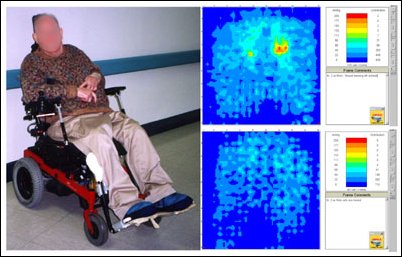 Figure 12: Pressure map with (top) and without (bottom) a wound dressing. The dressing adds pressure to the wound.