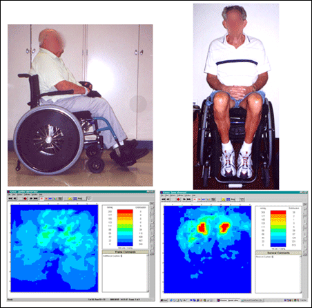 Figure 3: Two different subjects sitting on the same wheelchair cushion have very different results.