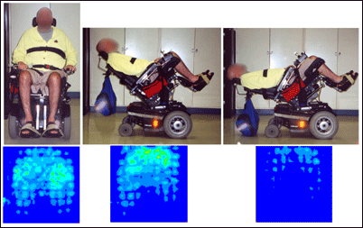 Pressure Mapping Assessment for Wheelchair Users