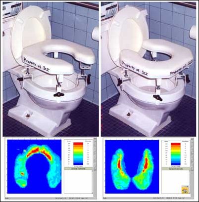 Figure 7: On the left the high pressure areas are located in the tailbone area, where the patient had an active wound. Turning the toilet seat around (right) takes pressure off the wound.